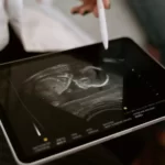 Ultrasound Medical Imaging: Bridging Technology and Healthcare