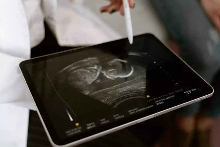Ultrasound Medical Imaging: Bridging Technology and Healthcare